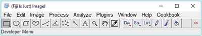 SpotMetrics: An Open-Source Image-Analysis Software Plugin for Automatic Chromatophore Detection and Measurement